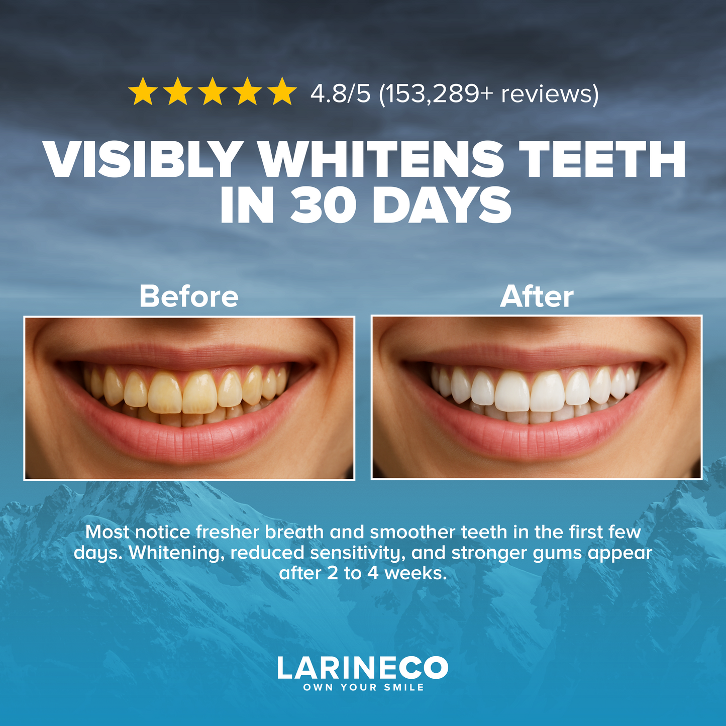 Larineco™️ - Whitening Strips