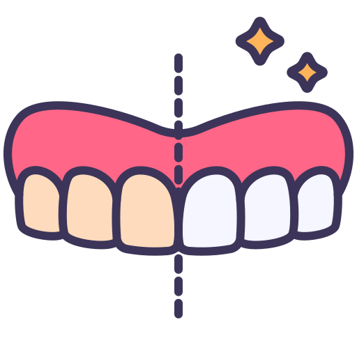 Tooth whitening before and after