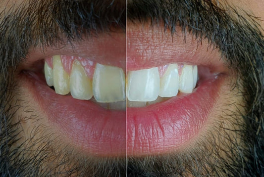 The 12-Month Smile Transformation