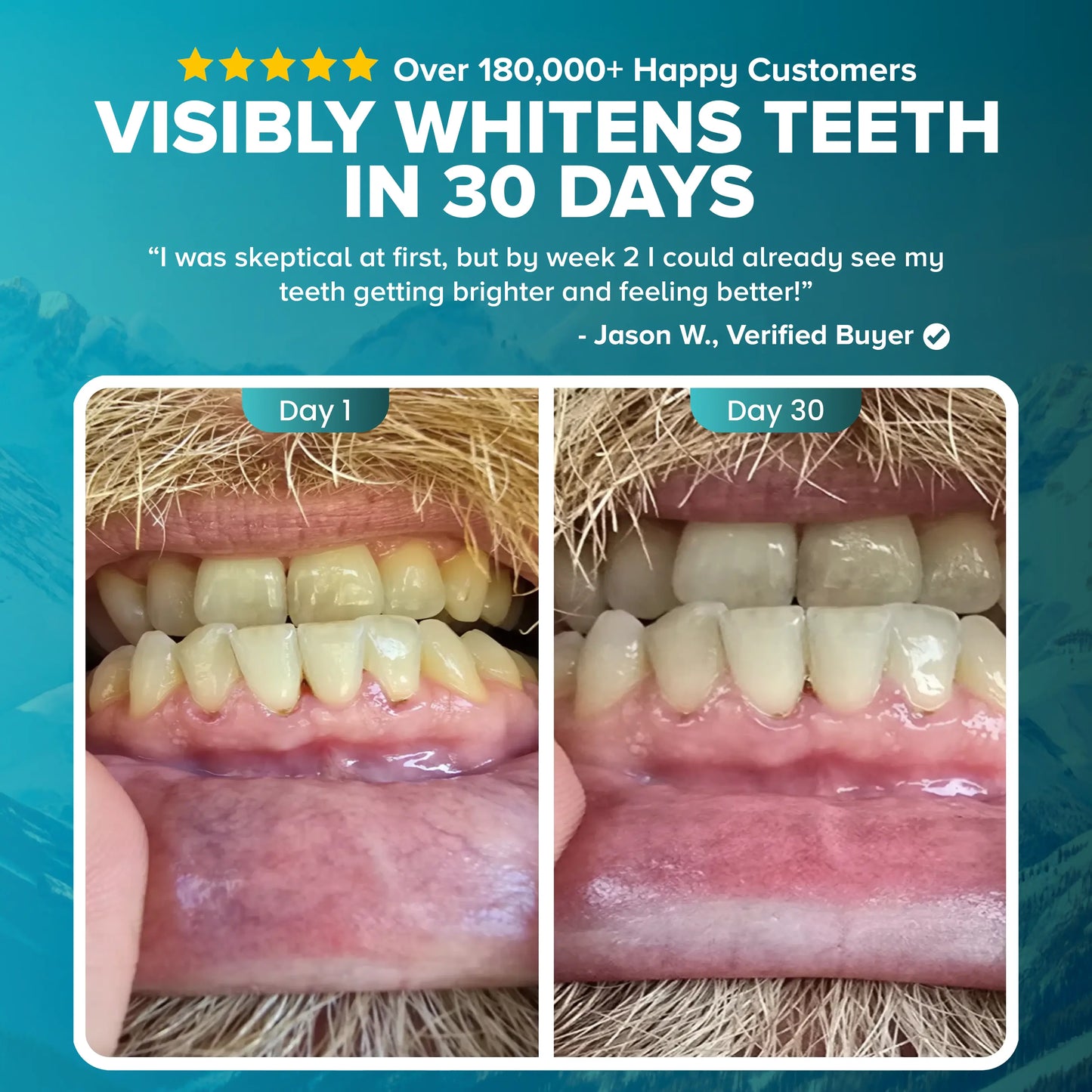 Larineco™️ - Dissolvable Remineralizing & Whitening Strips